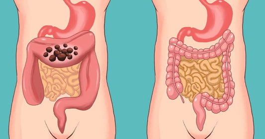 Cómo limpiar el intestino de heces y gases